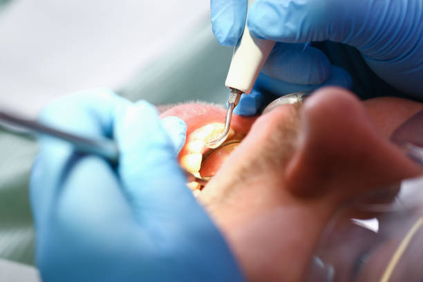 Best Broken or Cracked Tooth Emergency Dentist in Elgin, TX