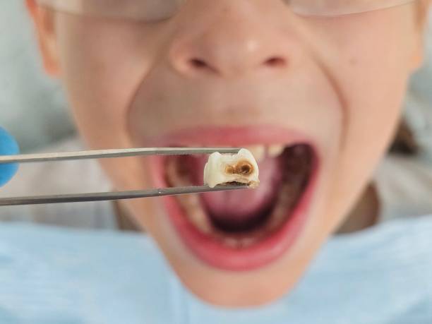 Best Broken or Cracked Tooth Emergency Dentist in Elgin, TX